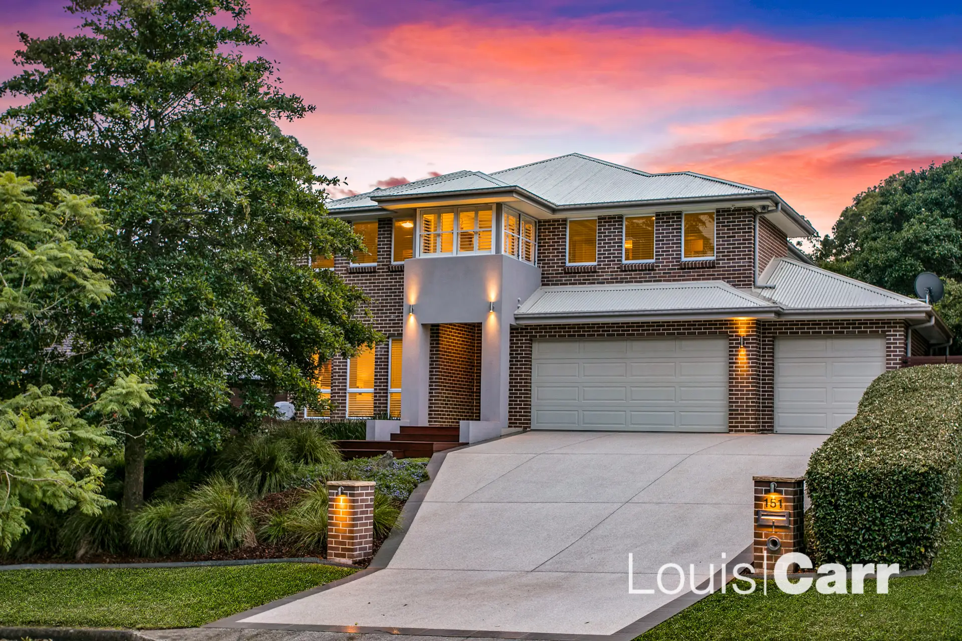 151 Oratava Avenue, West Pennant Hills Sold by Louis Carr Real Estate - image 1